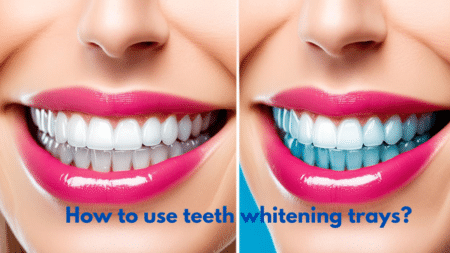 teeth whitening trays