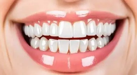 Snow Teeth Whitening