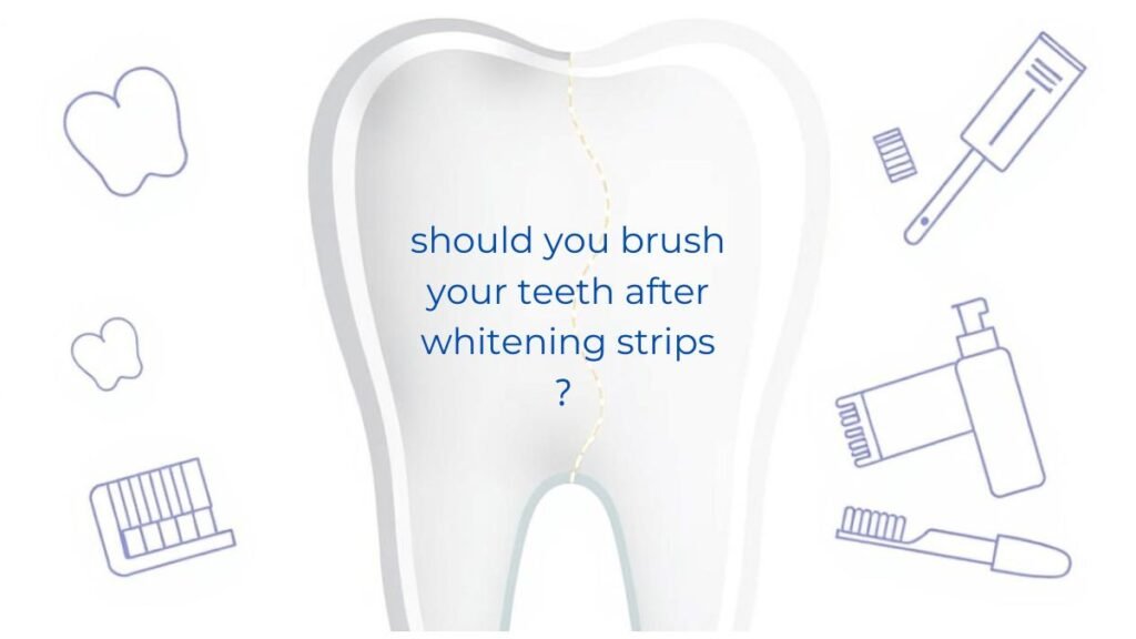 should you brush your teeth after whitening strips