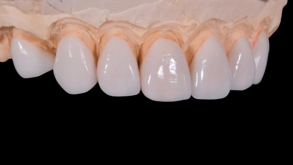 dental implants with medicare